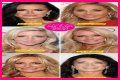Botox, Implants & More! – Hollywood Life